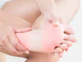 Mycose : découvrez 4 méthodes naturelles contre les candidoses soigner une mycose