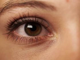 comment réduire les cernes naturellement