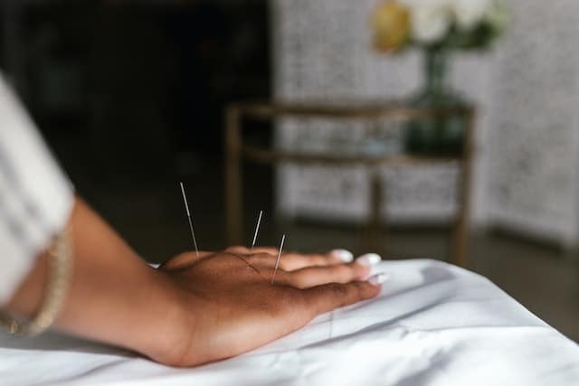 Les avantages de l’acupuncture pour la santé et le bien-être